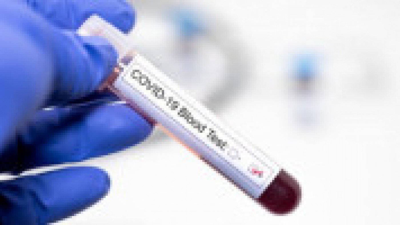 Test de coronavirus. GETTY IMAGES