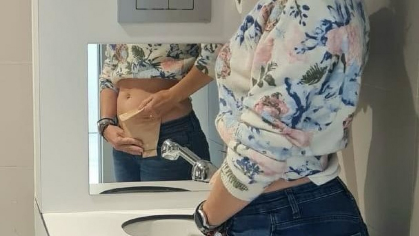 Día mundial de paciente ostomizado