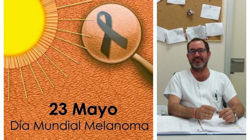 Pablo Cerezuela, oncólogo cartagenero experto en melanoma