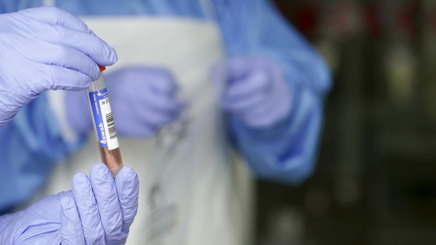 Aumenta hasta 95 el número de fallecidos diarios en España y también suben los contagios
