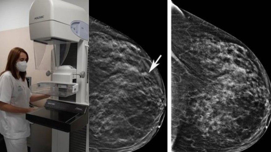 El protocolo de Radiología de la Arrixaca que permitirá diagnósticos más rápidos