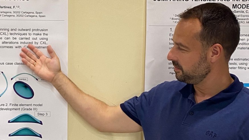 Innovando con la UPCT. Premio internacional para los gemelos digitales de córneas