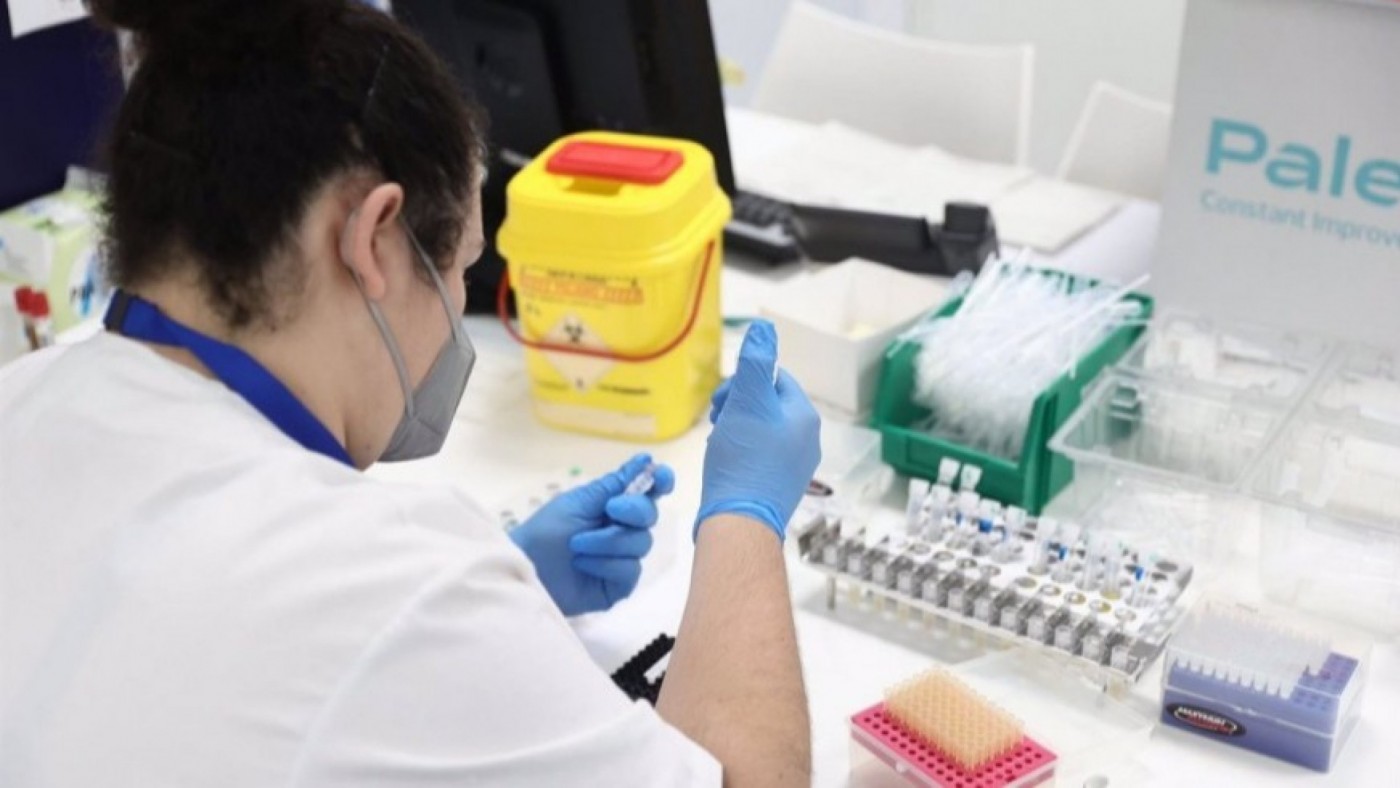Salud ha administrado ya 63 dosis de la vacuna contra la viruela