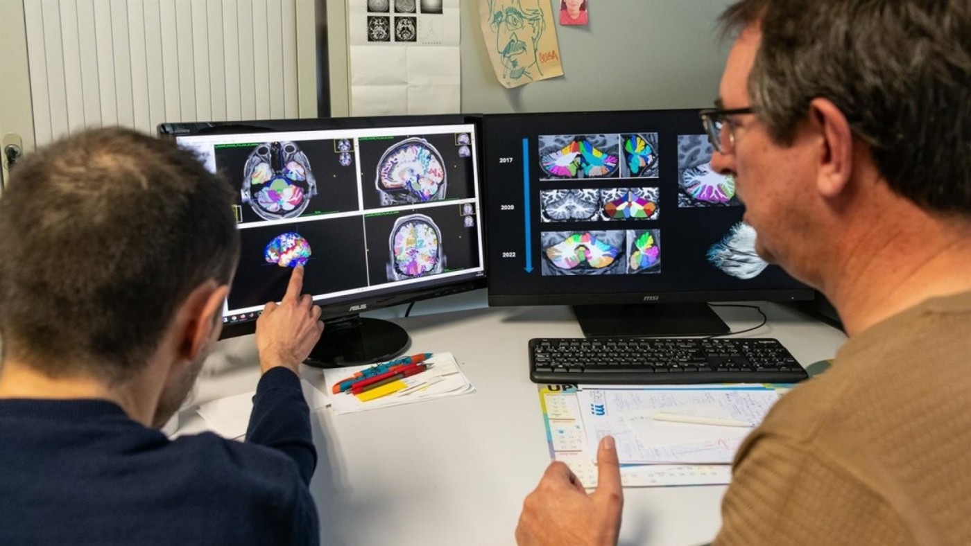 Una de cada diez personas sufrirá una crisis epiléptica a o largo de su vida