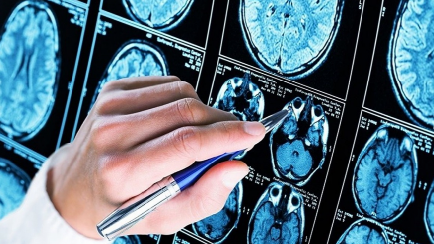 Imagen de pruebas médicas en el cerebro