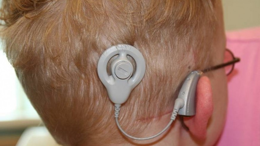 Implantes cocleares y neumología en Reacción en Cadena