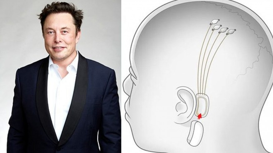 Elon Musk junto a un dibujo de Neuralink