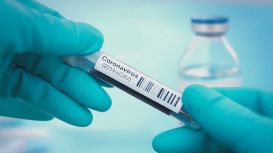 Sanidad registra 84 casos de Covid-19 en un día y ningún fallecido en las últimas 24 horas