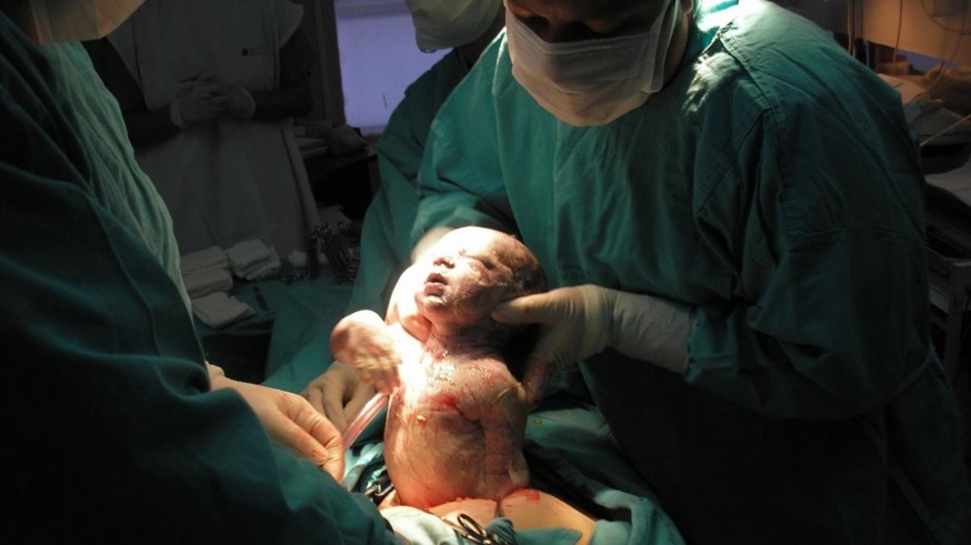 Se acabó el parto por cesárea en soledad