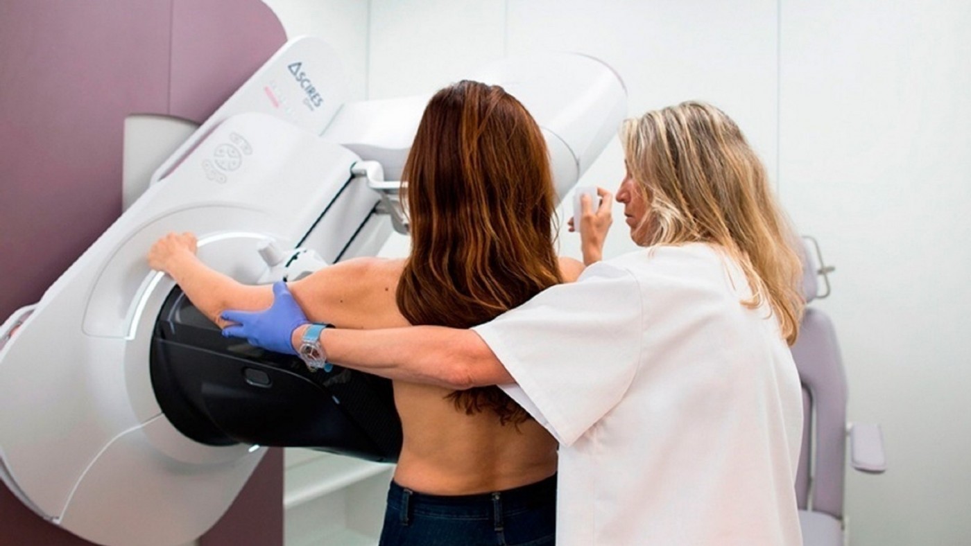  Salud asumirá por completo el cribado de cáncer de mama a partir del verano