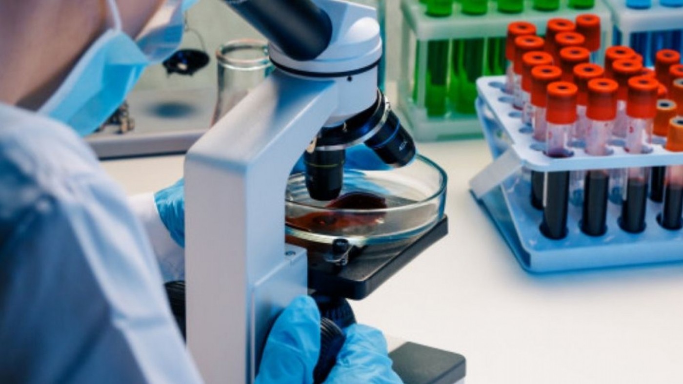 Las 'Superbacterias' provocan más de 20.000 fallecimientos al año
