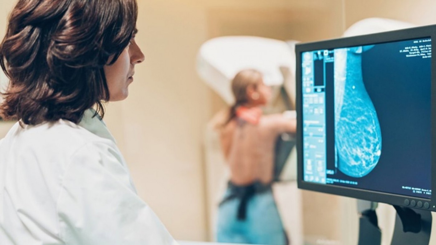Sanidad amplía el cribado de cáncer de mama a mujeres de entre 45 y 74 años