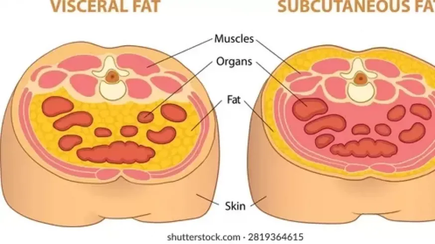 Con sumo gusto: cómo evitar la grasa visceral