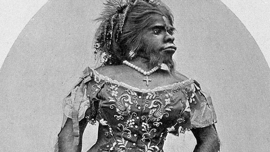 Apuntes Históricos, con Juancho Sánchez Ocaña. Julia Pastrana y el Negro de Banyoles