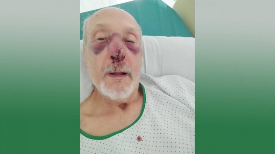 Crece en Murcia el método del robo por tirón