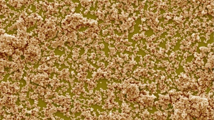 Plantar hortalizas combinadas reduce la propagación de bacterias resistentes a los antibióticos