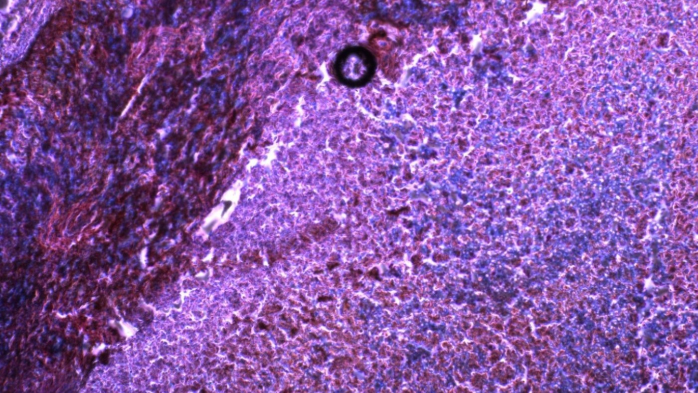 Descubren una biomolécula que ayuda al sistema inmunológico a superar el cáncer