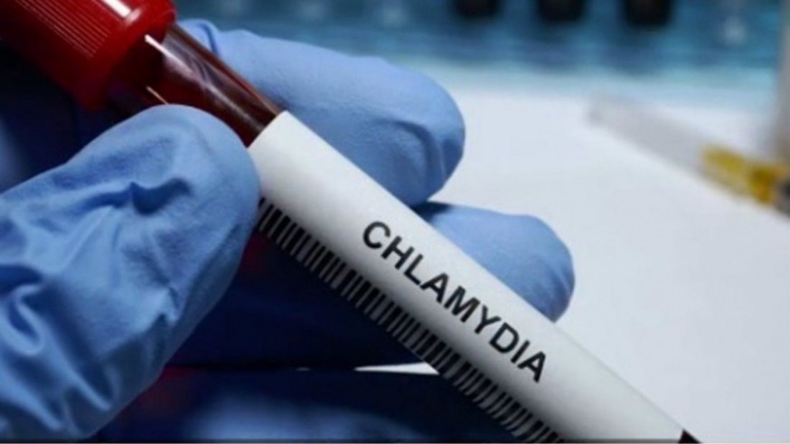 Los casos de clamidia aumentan un 1.000% entre mujeres jóvenes en la Región