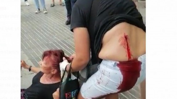 La mujer apuñalada retiene a su agresora hasta la llegada de la Policía. CEDIDA