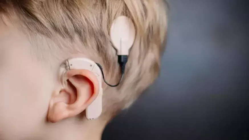 400 murcianos pueden oir gracias a un implante coclear