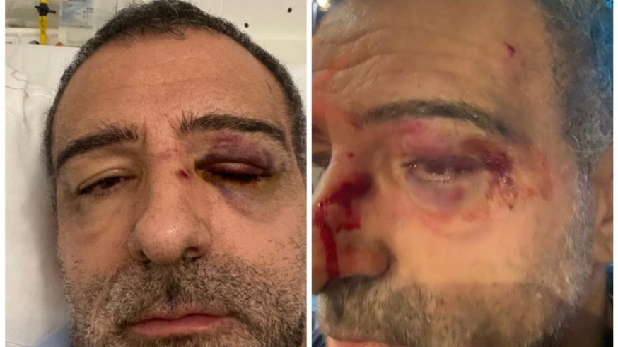 La agresión que sufrió un policía Nacional en Murcia amenaza su carrera