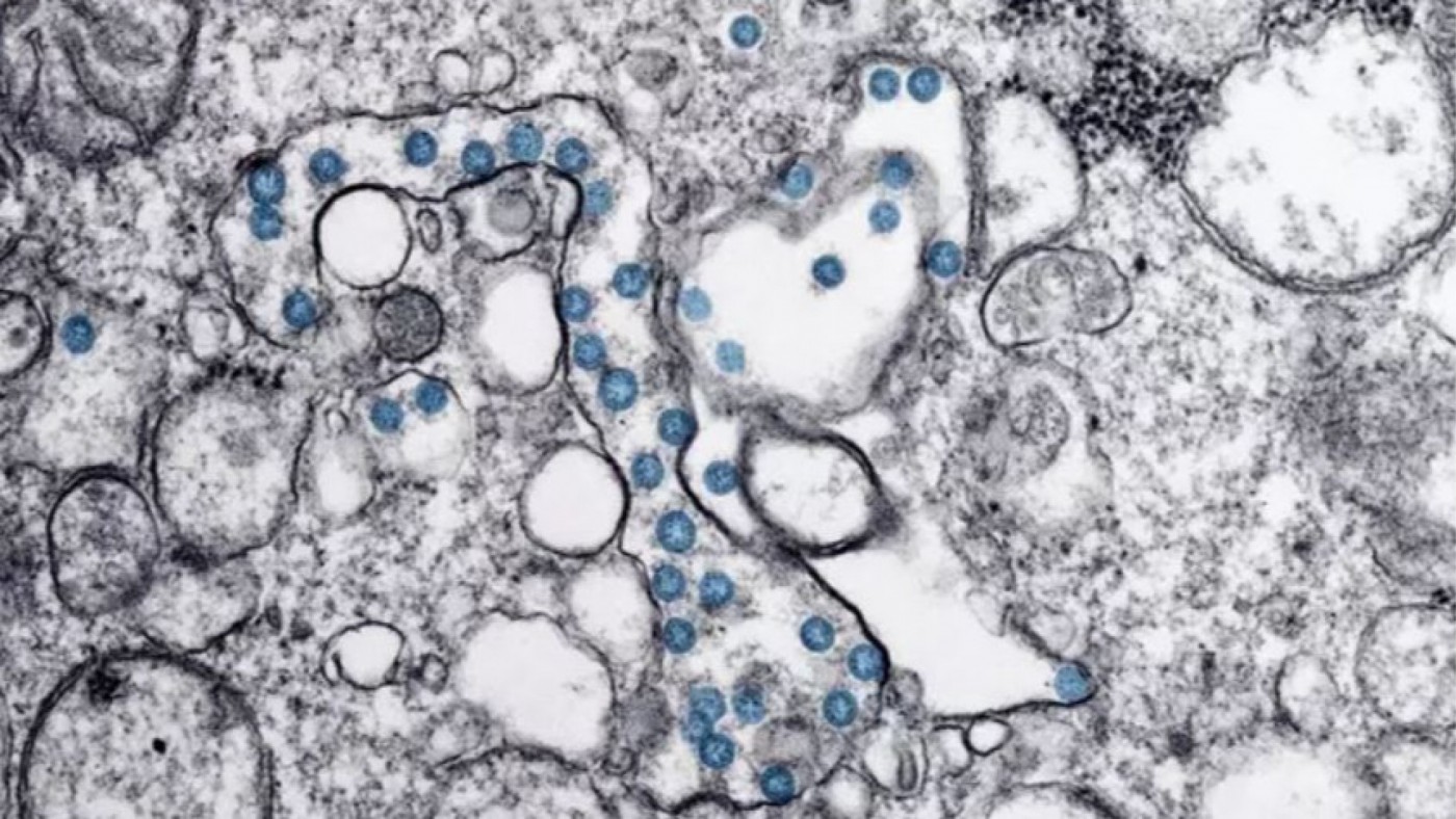 Partículas del virus SARS-CoV-2, coloreadas en azul, en una imagen de microscopio de electrones. CSIC