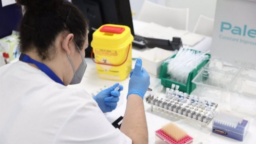 Salud ha administrado ya 63 dosis de la vacuna contra la viruela