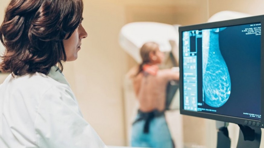 Sanidad amplía el cribado de cáncer de mama a mujeres de entre 45 y 74 años