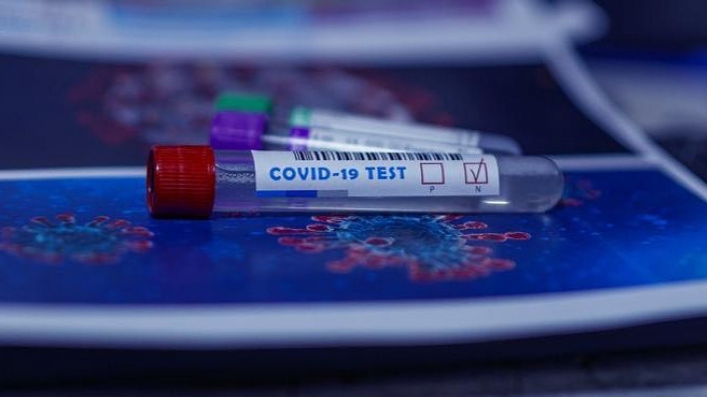 Covid a la baja en la Región de Murcia: 383 positivos y 4 fallecidos este sábado